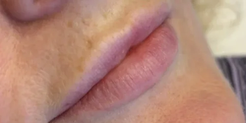 Pale lips before lip blush permanent makeup, Cheshire
